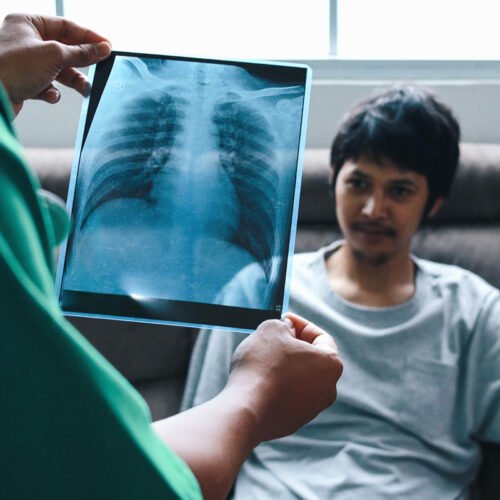 LUNG SCREENING PROFILE
