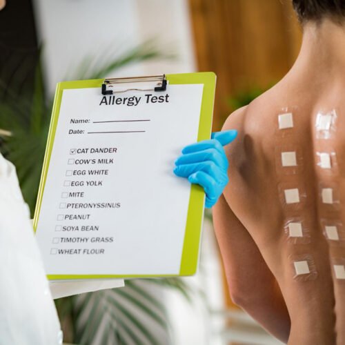 ALLERGY TESTING